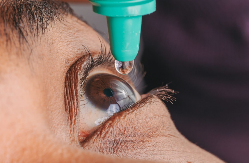 Close-up of person using eye drops to relieve dry eye symptoms.